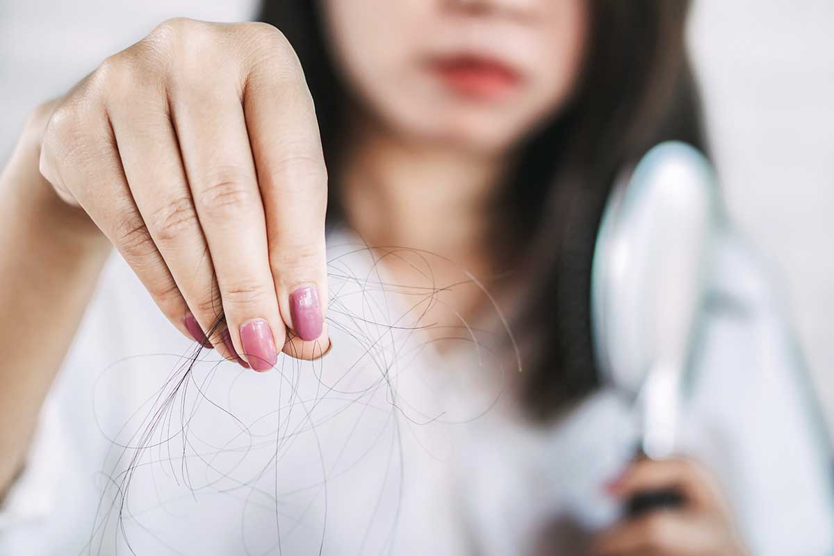 Alopezie – Haarausfall 2